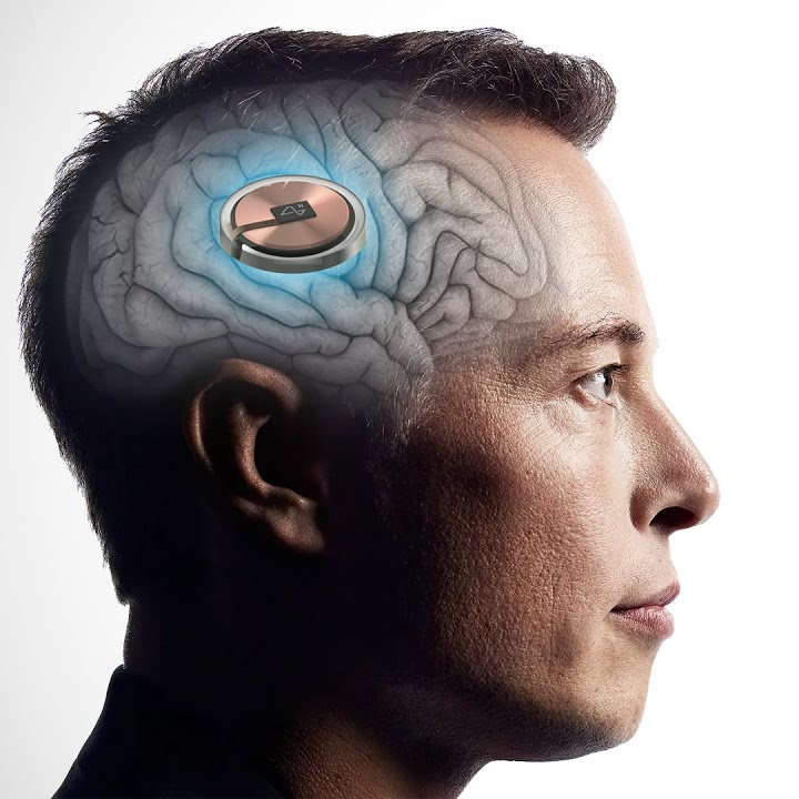 bpthaber's tweet photo. Elon Musk, Neuralink'ten beyin çipi nakledilen ilk insan hastanın tamamen iyileştiğini ve düşüncelerini kullanarak bir bilgisayar faresini kontrol edebildiğini aktardı. https://t.co/EecqdmSstM