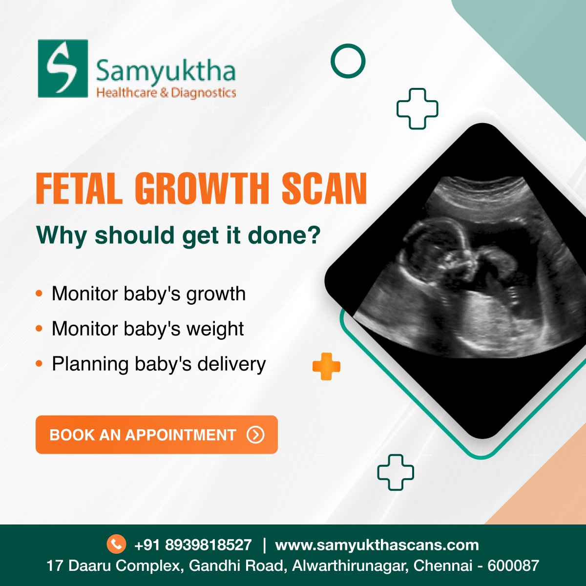Keep track of your little one's growth with a Fetal Growth Scan! 🌟

Contact Us: +91 8939818527
WhatsApp Us: wa.link/pp5i1l

#FetalHealth #BabyGrowth #PrenatalCare #FetalGrowthScan #PregnancyMonitoring #BabyDevelopment #UltrasoundCheckup #HealthyPregnancy #Pregnancy