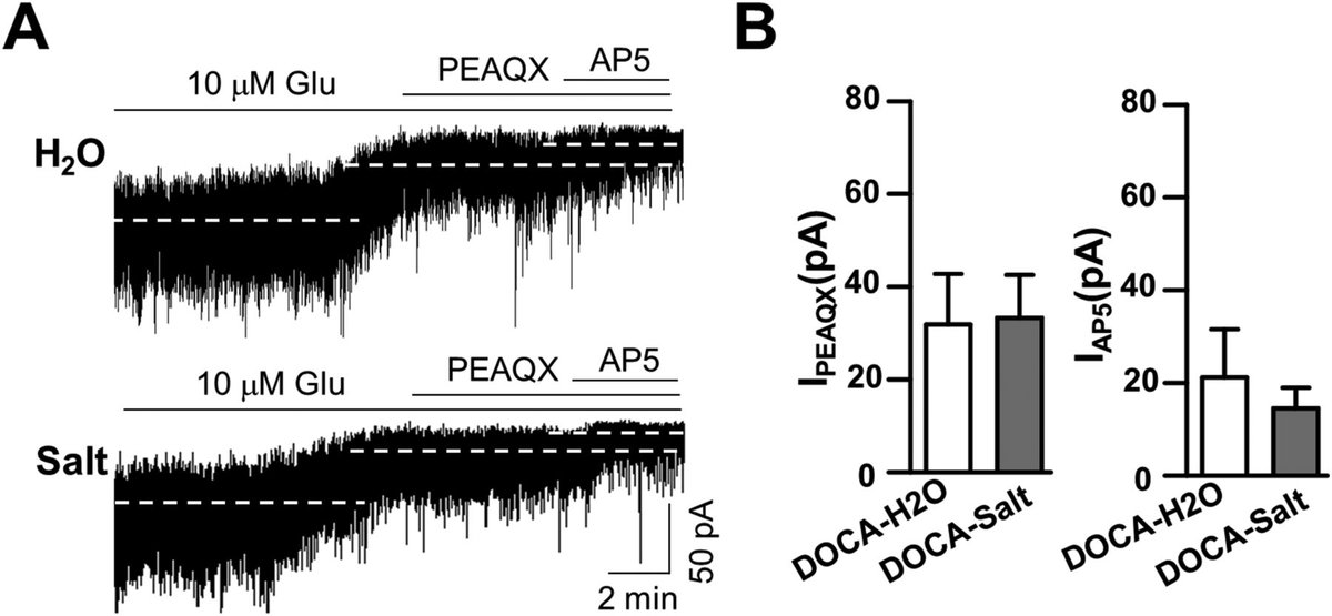SfNJournals's tweet photo. #eNeuro: Research in rats from Shin, Sharma et al. shows that NR2A-containing NMDARs could be a biosensor detecting ambient glutamate concentration in the brain.
https://t.co/pLGtb2vvV3 https://t.co/ycMm4zag7u