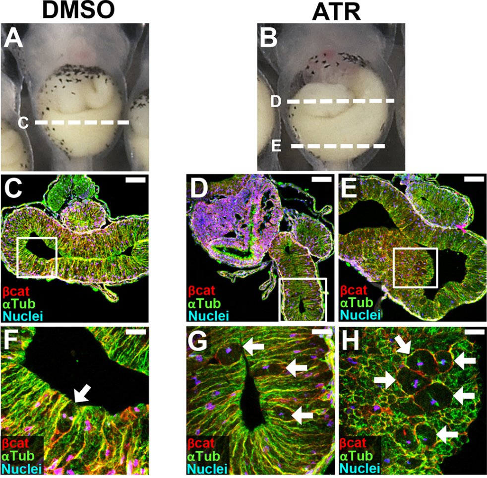 Cellular metabolism keeping the gut in the loop

Read this Research Highlight showcasing work from Julia Grzymkowski, Yu-Chun Chiu, Dereje Jima, Brent Wyatt, Sudhish Jayachandran, Whitney Stutts &amp; Nanette Nascone-Yoder <a href="/NCStateVetMed/">NC State Vet Medicine</a> <a href="/NCState/">NC State University</a>:

journals.biologists.com/dev/article/15…
