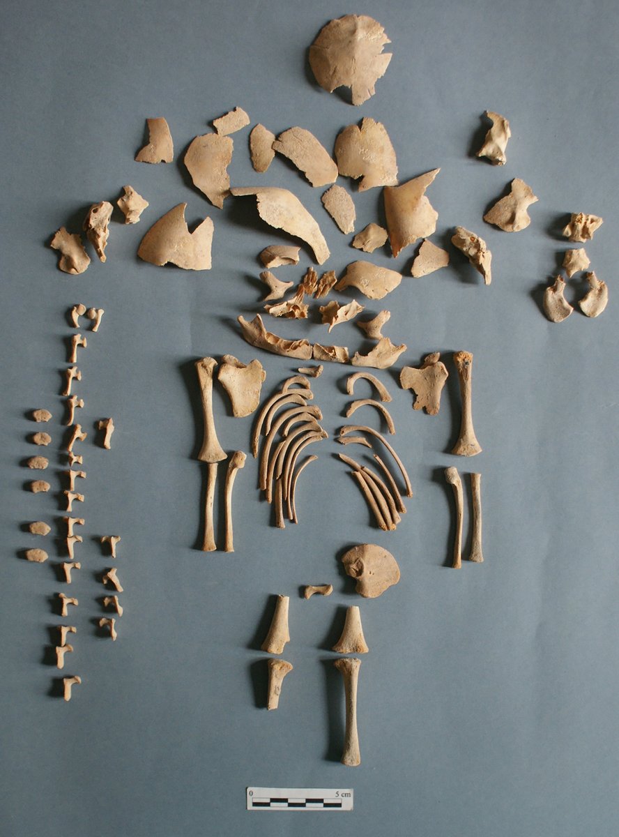 MPI-EVA Leipzig (@mpi_eva_leipzig) on Twitter photo Ancient genomes reveal Down Syndrome in past societies. Burials within settlements & often w/ grave goods show children w/ Down Syndrome were recognized as members of their communities. Study by @BRohrlach et al. in <a href="/NatureComms/">Nature Communications</a>. tinyurl.com/3khxj4vy & nature.com/articles/s4146… Ancient genomes reveal Down Syndrome in past societies. Burials within settlements & often w/ grave goods show children w/ Down Syndrome were recognized as members of their communities. Study by @BRohrlach et al. in <a href="/NatureComms/">Nature Communications</a>. tinyurl.com/3khxj4vy & nature.com/articles/s4146…