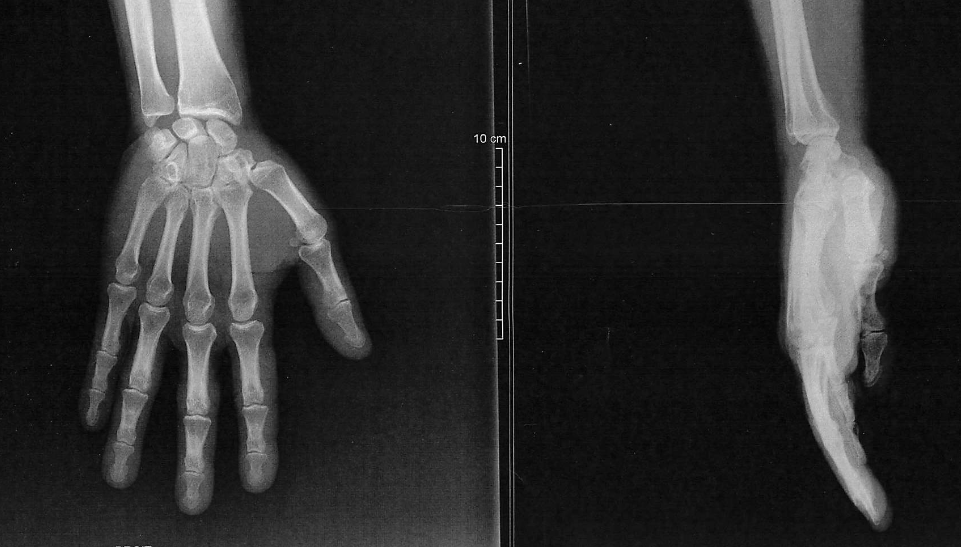 Dr Jean-Jacques Fraslin tweet media