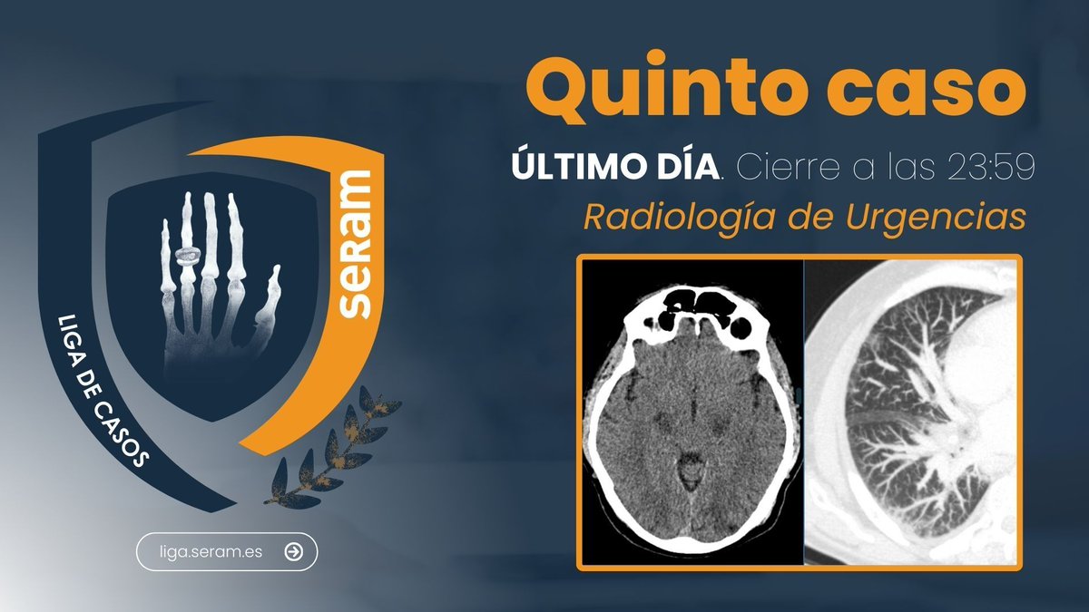 📣 Recuerda que hoy es el último día para contestar al caso de la #LIGASERAM Si habéis esperado hasta el último momento 😱 , ¡no esperéis más! ¡Poneos a prueba y contestad ya a las preguntas! 🧐 ➡️ liga.seram.es @SERAM_RX