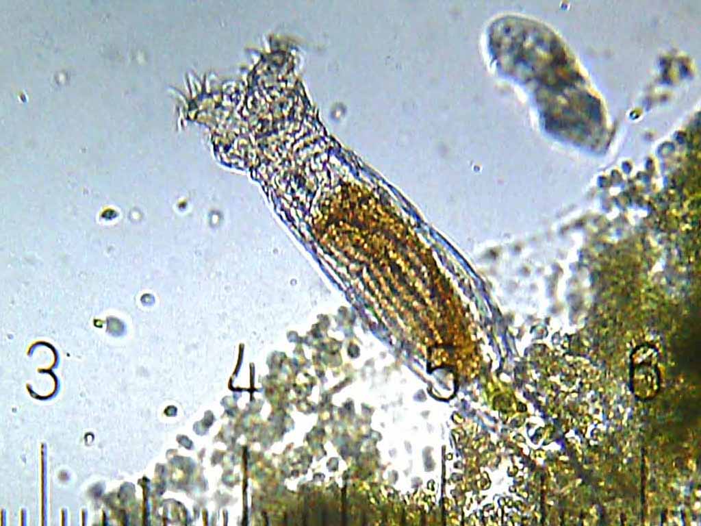 AlienNextDoor's tweet image. How the Bdelloid Rotifer Lived for Millennia — Without Sex #rotifers #bdelloid #rotifer #aquatic #life  ninamunteanu.me/2020/12/13/how…