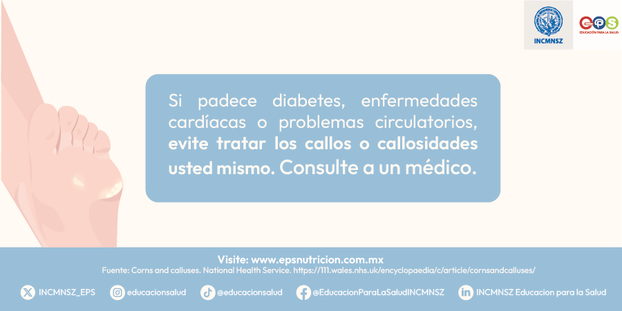 INCMNSZ_EPS's tweet photo. #Callosidades | Instituto Nacional de Ciencias Médicas y Nutrición Salvador Zubirán  

#salud #medicina #callos #callosidades #calcetines #plantillas #zapatos  #hidratación #taloneras #diabetes #pies #manos #piel #diabetes #circulación #cardiología  #descalzos #EPS #INCMNSZ https://t.co/bdZ9mXZDgQ