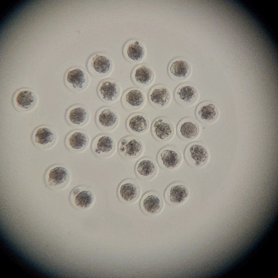 dairemarkham's tweet image. One of those days 😊 #embryotransfer