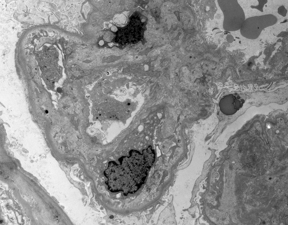 JZRenalPath tweet picture