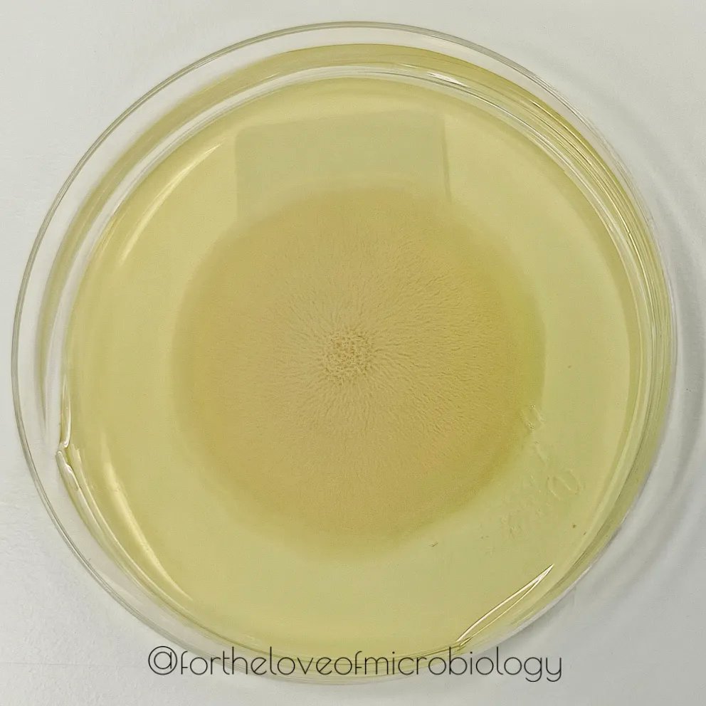 Geotrichum species on microscopy and culture plate

#Fortheloveofmicrobiology #clinicalmicrobiology
 #mmidsp #microrounds #IDpath #ASMClinMicro #MicroTwitter #WomenInSTEM #WomeninMicrobiology #STEM #medtwitter #ClinMicro #microbiologypakistan #PathBugs