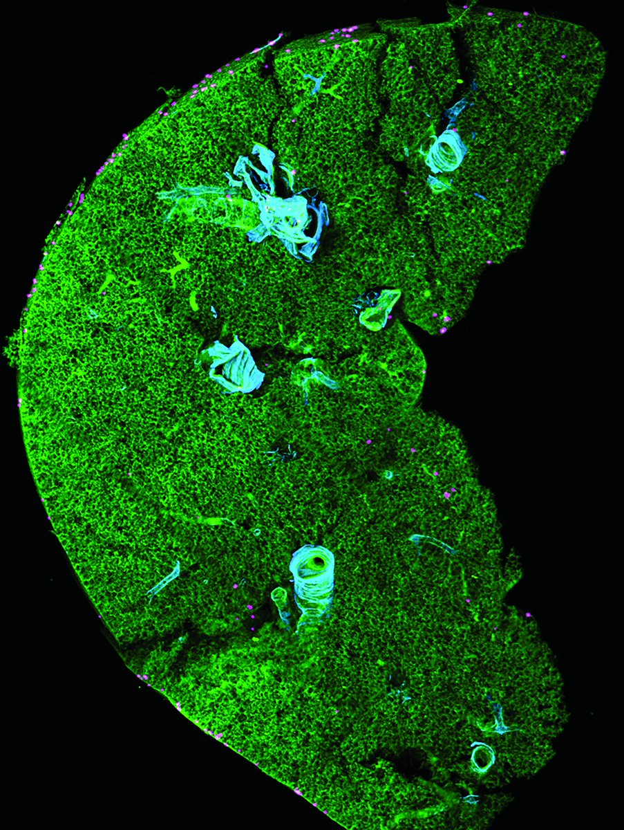 This week #FluorescenceFriday🔬is a whole lung lobe cleared for our light sheet test👀 Green blood vessels, cyan smooth muscle cells and purple mast cells 🤩at @ImperialNHLI @lloyd_lab with @ImarisSoftware