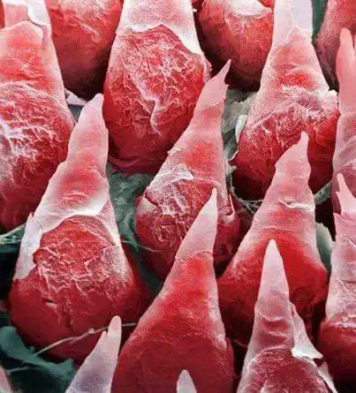A human tongue under a microscope