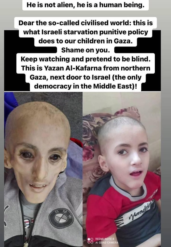 Rest in peace Yazan💔