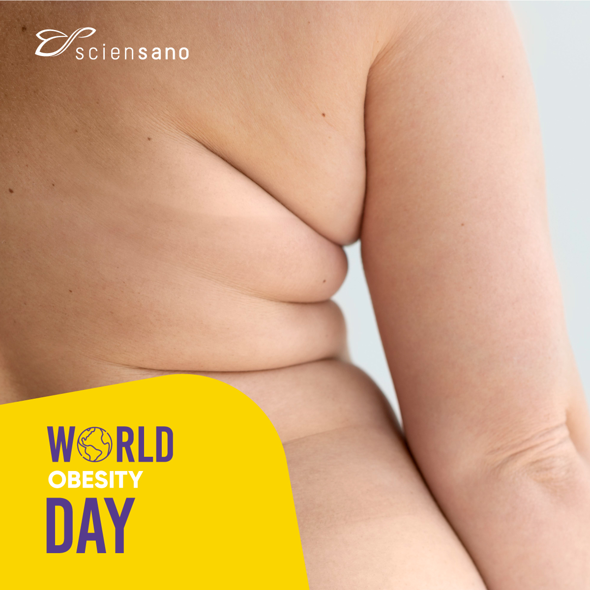 #WorldObesityDay | Volgens onze laatste cijfers heeft meer dan de helft van de Belgische bevolking overgewicht en lijdt naar schatting 16% aan obesitas. Mensen met overgewicht hebben meer kans op onder andere hart- en vaatziekten en kanker.