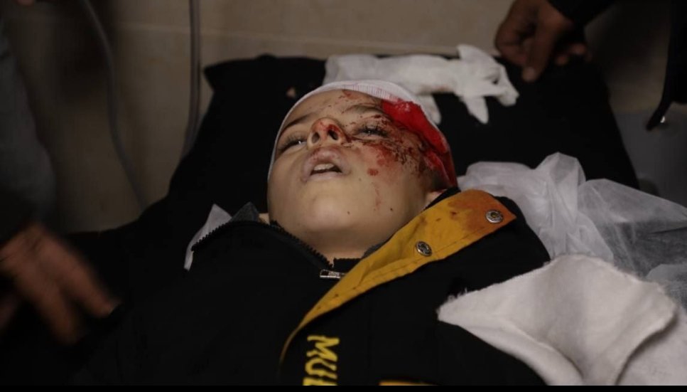 Timesofgaza's tweet photo. BREAKING | West Bank: 10 year old boy 'Amru Al-Najjar has succumbed to his wounds after being shot by an IOF soldier during a raid in  the village of Burin, South of Nablus https://t.co/NsHJXDy4vA