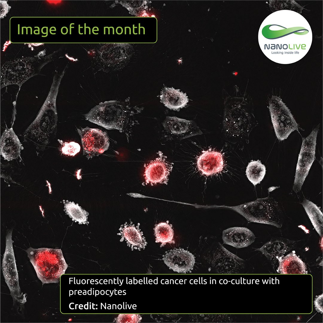 NanoLiveLtd's tweet image. 🥼 Image of the month: Fluorescently labeled cancer cells with preadipocytes. Early apoptotic membrane blebbing visible after drug treatment. Explore more stunning images in our 2024 calendar: bit.ly/49DlU3B
#ImageOfTheMonth #CellImaging #Nanolive