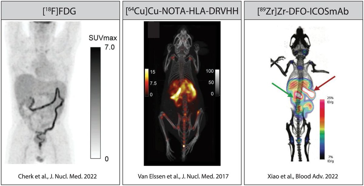 Molecular imaging of acute graft-versus-host disease (GvHD) after allogeneic hematopoietic stem cell transplantation has great potential to detect GvHD at the early stages. ow.ly/fi0R50QGiQm #MolecularImaging #HSCT #NuclearMedicine @Israt_Alam
