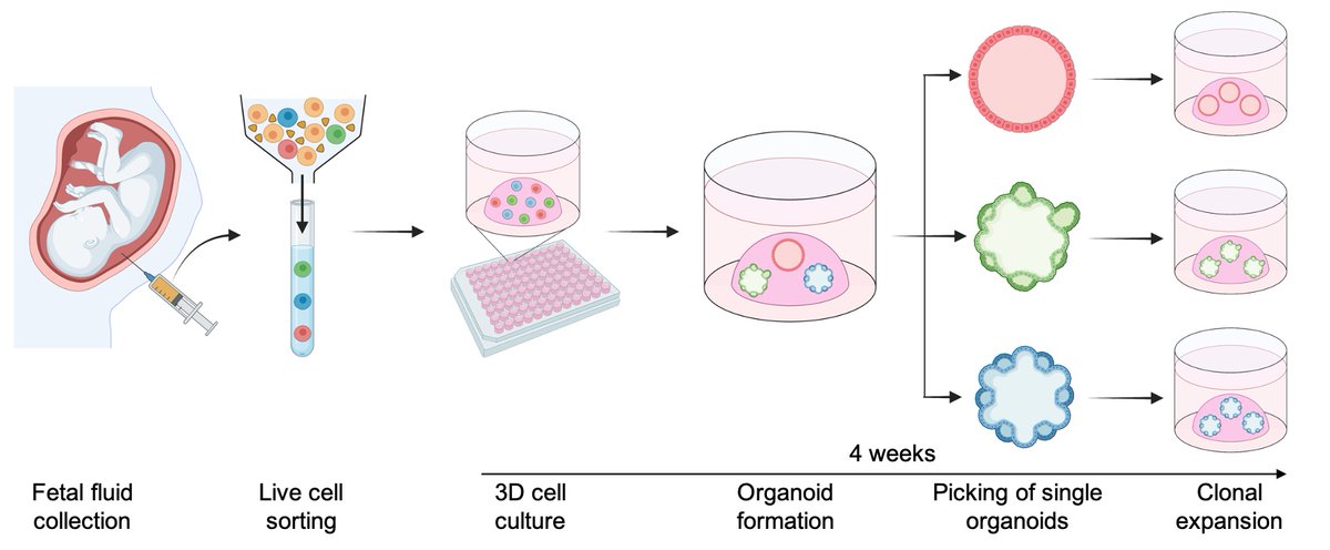 Mattia FM Gerli, PhD (@gerlilab) on Twitter photo Thrilled to share that our article on primary organoids derivation from human amniotic and tracheal fluids, is now out on <a href="/NatureMedicine/">Nature Medicine</a>
We present the first atlas of the unperturbed human amniotic fluid cells, containing epithelial progenitors of fetal small intestine, kidney Thrilled to share that our article on primary organoids derivation from human amniotic and tracheal fluids, is now out on <a href="/NatureMedicine/">Nature Medicine</a>
We present the first atlas of the unperturbed human amniotic fluid cells, containing epithelial progenitors of fetal small intestine, kidney