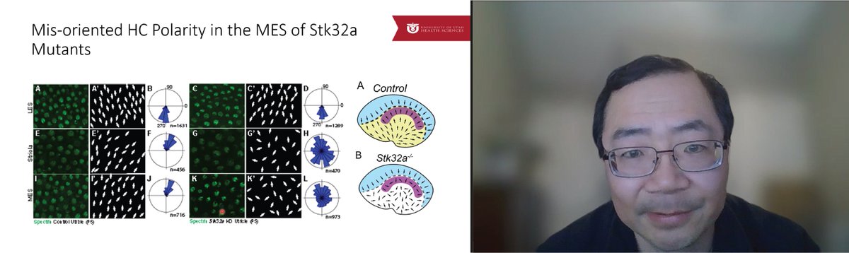 ShiHai Jia from my lab just gave a great update of ongoing research for UofUtah Otolaryngology faculty As you can see, we are growing really fond of an obscure kinase called STK32a and its role in regulating Planar Cell Polarity