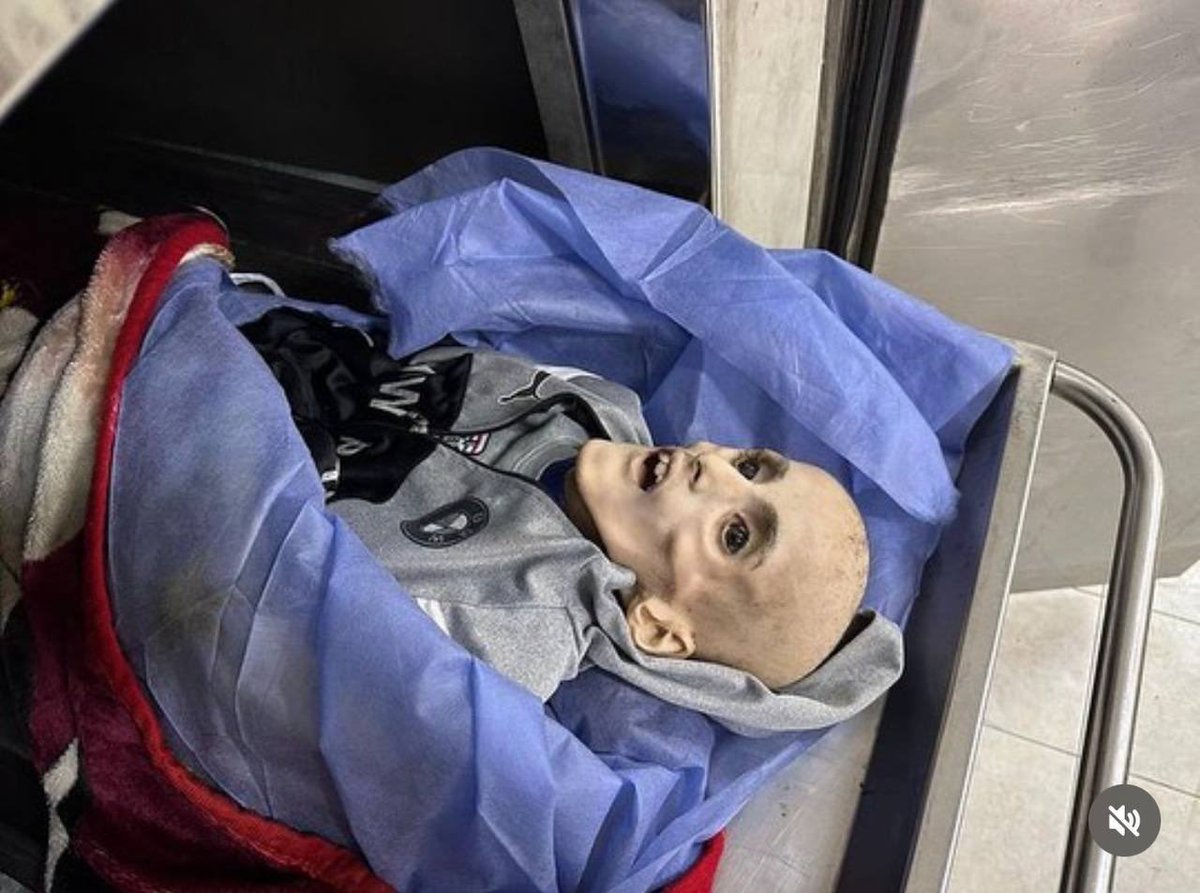 استشهاد الطفل يزن الكفارنة، في مستشفى أبو يوسف النجار برفح بسبب سوء التغذية

The child Yazan Kafarnah dies in Rafah, Gaza from malnutrition due to Israel’s ongoing siege, depriving over 2 million people in Gaza of food and water