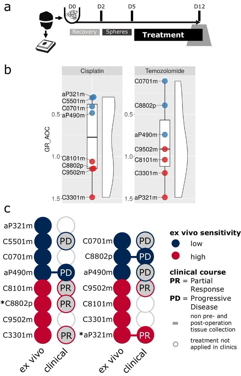 Congratulations to @AurelPerren and @ilamarinoni and team. Patient-derived tumoroids of high-grade NEC for therapy response prediction and vulnerabilities identification. A step forward toward precision medicine in #NEN. A joint effort @ChariteBerlin 👉 link.springer.com/article/10.103…