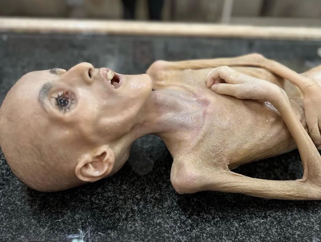 Başınızı çevirmeyin uzaylı değil.!

Açlıktan ölen gazzeli çocuklardan biri..💔😔