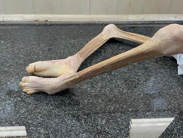 صورة