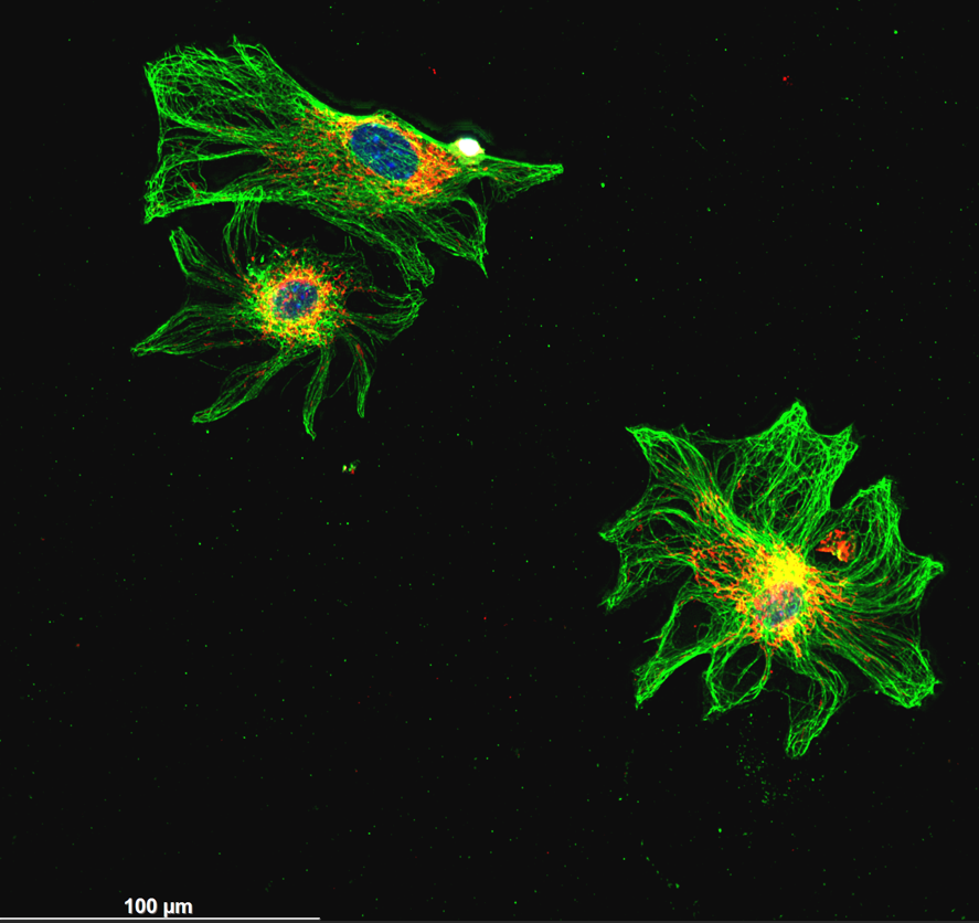 Did you know that mesenchymal stem cells come in all shapes and forms? For this #MicroscopyMonday I bring you some flower-shaped as the IWD approaches🌸.