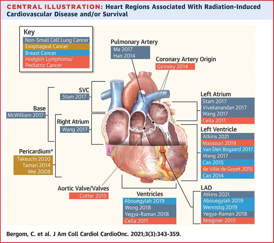 🔴 Past, Present, & Future of Radiation-Induced Cardiotoxicity: Refinements in Targeting, Surveillance, and Risk Stratification : State-Of-The-Art Review #OpenAccess 

jacc.org/doi/10.1016/j.…
#cardiology #CardioEd #CardioTwitter