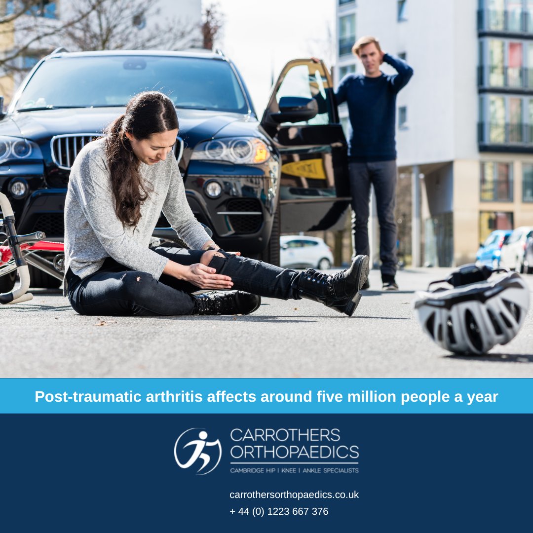 Carrothers Orthopaedics (@cambridgeorthos) on Twitter photo Approximately 10% of osteoarthritis cases are caused by post-traumatic arthritis.
If you're concerned about your symptoms, you can email our team at enquiries@carrothersorthopaedics.co.uk or call them on + 44 (0) 1223 667 376
#arthritis #osteoarthritis #cambridge Approximately 10% of osteoarthritis cases are caused by post-traumatic arthritis.
If you're concerned about your symptoms, you can email our team at enquiries@carrothersorthopaedics.co.uk or call them on + 44 (0) 1223 667 376
#arthritis #osteoarthritis #cambridge