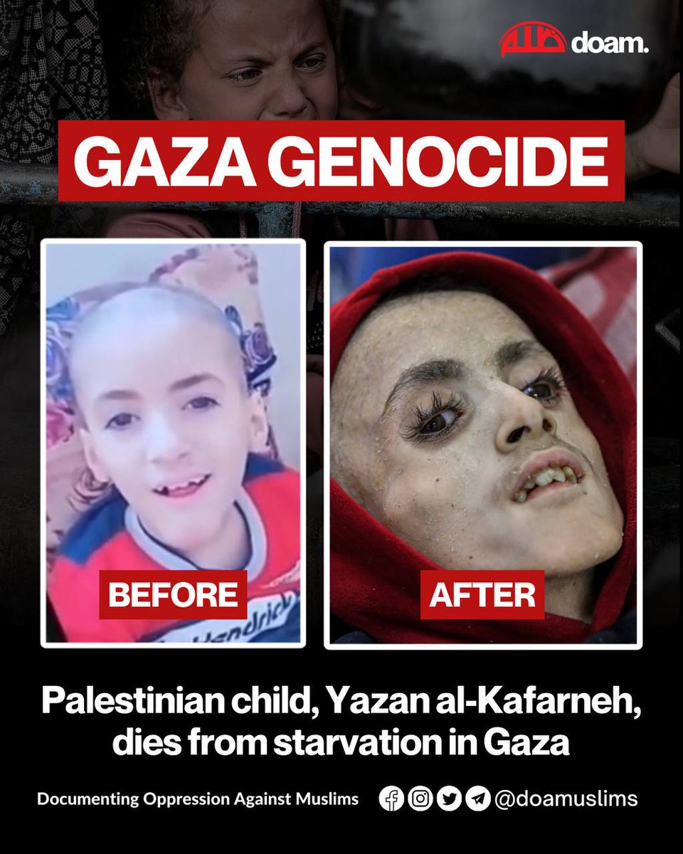 Bukan, Yazan Al Kafarneh Anak Gaza Palestina ini tewas bukan karena kelaparan, tapi dibantai oleh Penjajah Isrewel Laknatullah Alaihim #FreePalestine #GazaFamine #GazaStarving‌‌