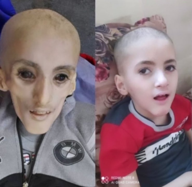 SoundousMLGN's tweet photo. He is not an alien, he is a #human being.
Dear this so-called #civilised_world: this is what Israeli starvation punitive policy does to our #children in #gaza.
#ShameOnYou https://t.co/inND7qLNEf