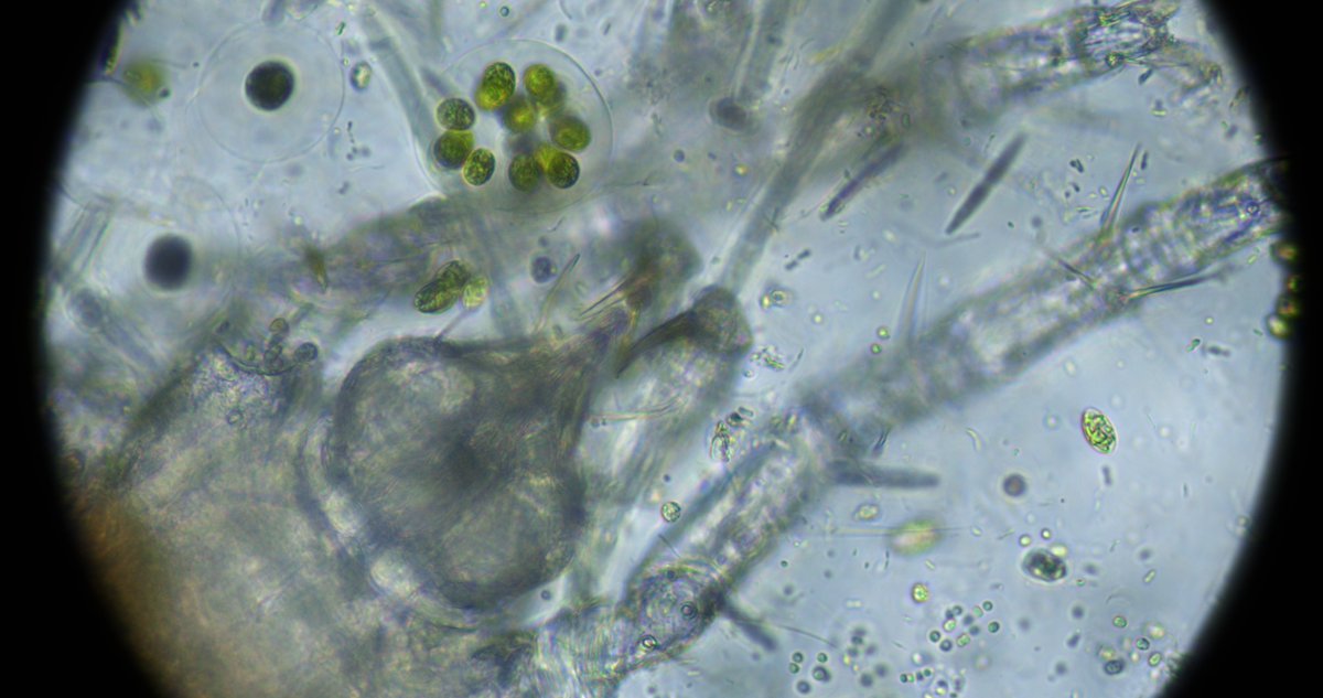 bkant's tweet image. Got no reactions here. How do you software fix this?

Chromatic aberrations filtering microbehunter.com/microscopy-for… #microscopy #imagefiltering #imageprocessing