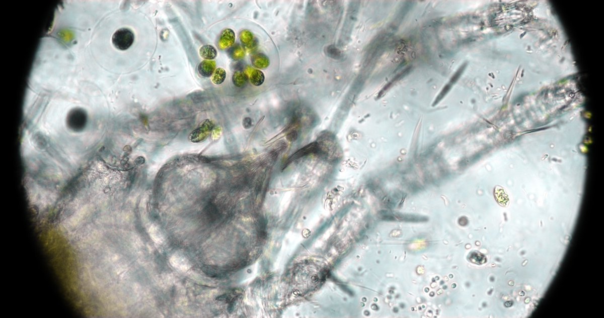 bkant's tweet image. Got no reactions here. How do you software fix this?

Chromatic aberrations filtering microbehunter.com/microscopy-for… #microscopy #imagefiltering #imageprocessing