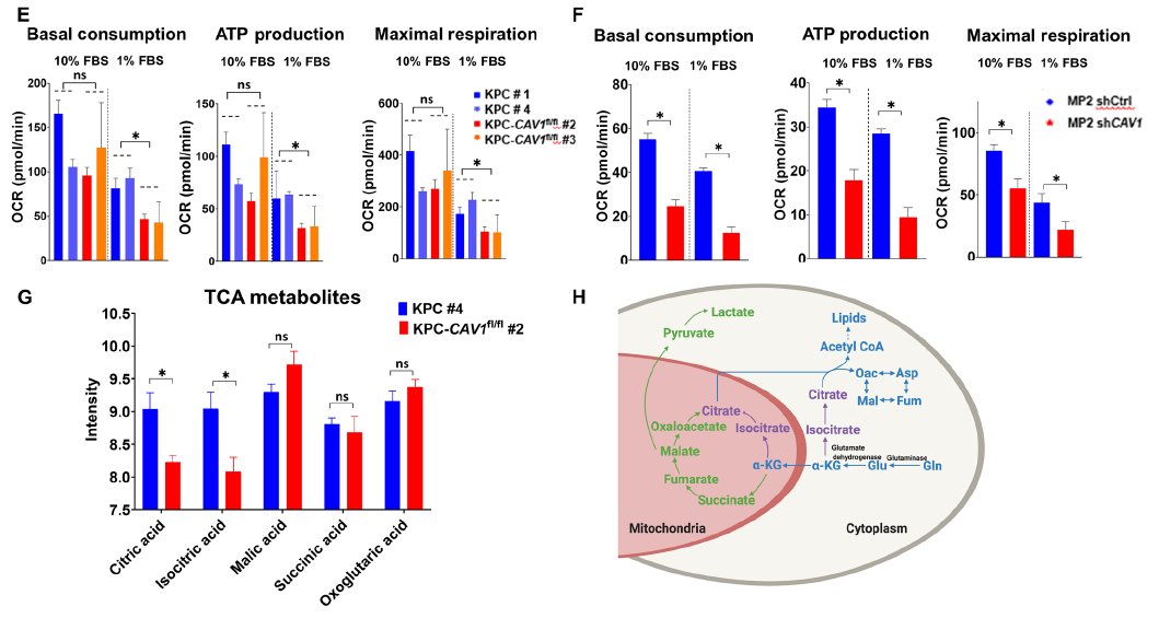 Terry Williams (@tewilliamsmd) on Twitter photo 7/n  Delving deeper, we found phenotypic alterations in  #tumor #metabolism, with defects in glycolysis and #mitochondrial metabolism in cells depleted of Cav-1.  These defects were pronounced under nutrient depleted conditions. 7/n  Delving deeper, we found phenotypic alterations in  #tumor #metabolism, with defects in glycolysis and #mitochondrial metabolism in cells depleted of Cav-1.  These defects were pronounced under nutrient depleted conditions.