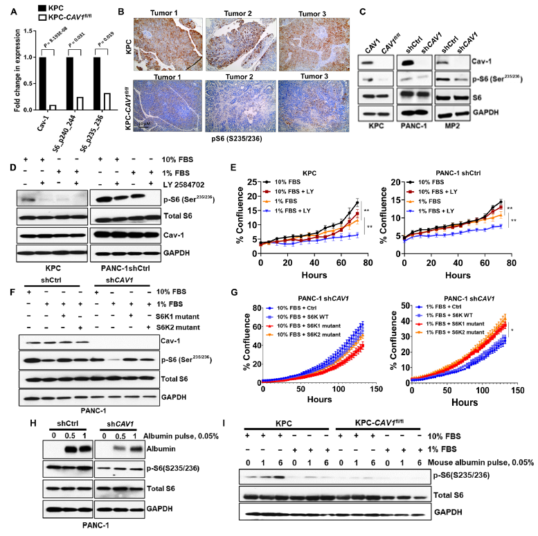 Terry Williams (@tewilliamsmd) on Twitter photo 9/n  Finally, we elucidate that Cav-1 mediated regulation of ribosomal S6 under conditions of nutrient stress are likely contributing to tumor growth and survival through ribosomal translation. 9/n  Finally, we elucidate that Cav-1 mediated regulation of ribosomal S6 under conditions of nutrient stress are likely contributing to tumor growth and survival through ribosomal translation.