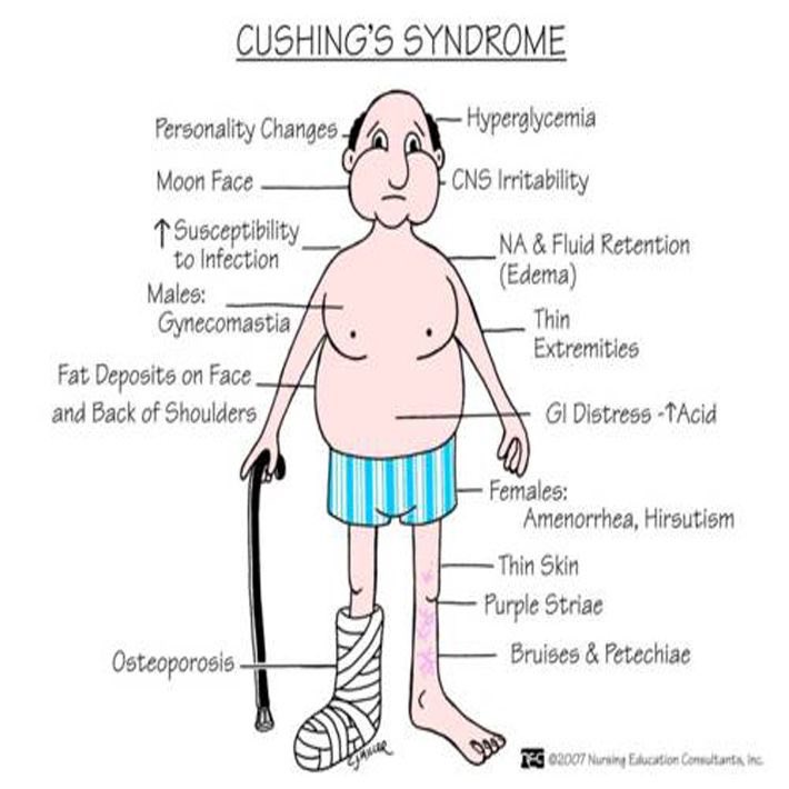 #MedTwitter #MBBS #MedEd #medX 
Cushing’s syndrome 
#signsandsymptoms