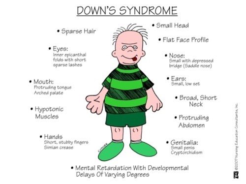 #MedTwitter #MBBS #MedEd #medX 
Down’s syndrome 
 #signsandsymptoms