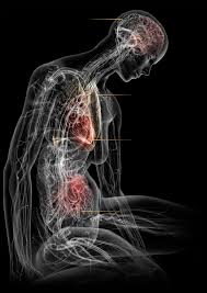 rbenLG's tweet photo. Mete en una coctelera #SFC, #fibromialgia y #covidpersistente.
Q sale?
Rubén
Pedro
Juan
Cris
Manu
Sonia
Laura
Pablo
Paco
Clara
Lucas
María
Iñigo
James
Nicole
Marco
Juliette
Nadia
Y así miles y miles
No somos invisibles
@sanidadgob
@Monica_Garcia_G
#longcovid
#LongCovidAwareness https://t.co/5dP10OIoYj