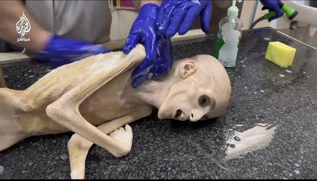 هكذا مات يزن الكفارنة يا عبد الفتاح ياسيسي اذاقك الله لباس الجوع والخوف