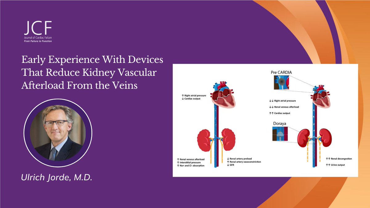 ⬆️ Kidney vascular congestion can worsen diuretic resistance in ADHF. @SpringMD @UlrichJordeMD explore this & device-based therapies for patients with renal venous congestion in the latest #JCF Ignite article in press. #THT2024 🔗 onlinejcf.com/article/S1071-…