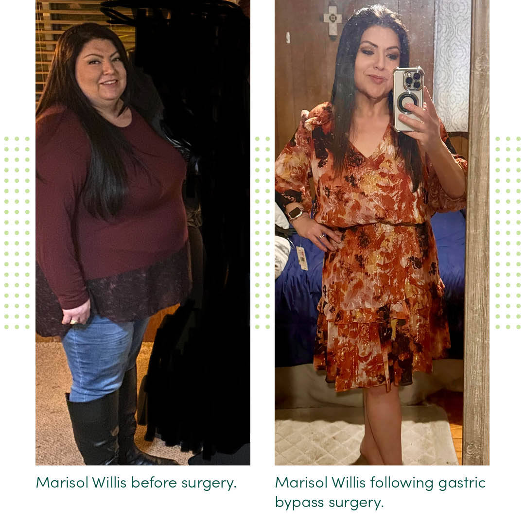 MercyOne_Iowa's tweet photo. Down 141 pounds, off insulin and blood pressure medications, Marisol feels healthier than ever! Learn how bariatric surgery changed her life. > https://t.co/WGlE66fGoy https://t.co/xpB7MxeF6L