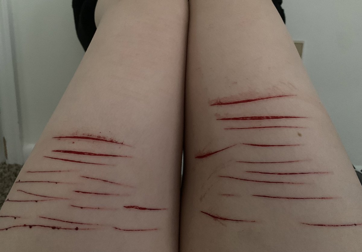 slxt4cals's tweet photo. tw// sh/cuts
I went deeper this time weeee
#shtwt https://t.co/Xf4QA2zwW4