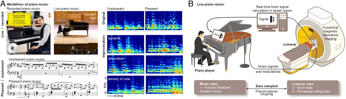 なぜ人は“録音”よりも“ライブ演奏”で感動するのか　スイスの研究者が解明　MRI内で音楽鑑賞して実験 itmedia.co.jp/news/articles/… 27人をMRI中に生演奏と録音音楽を聴きながら脳活動を調査した結果、生演奏（楽しいと不快な曲）の音楽を聴いた際は脳の左側にある扁桃体の活動が有意に増加した。