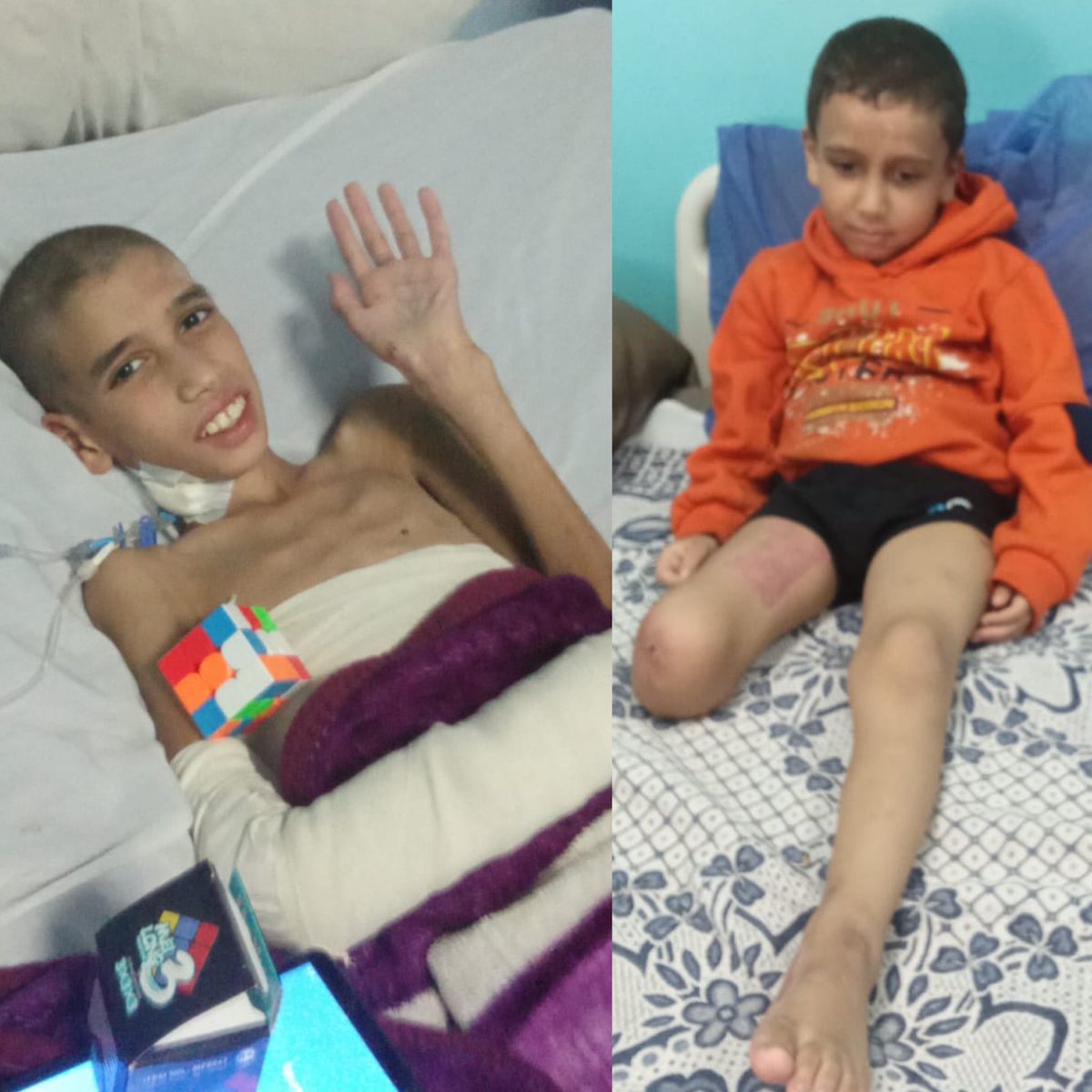 We need your help to bring two injured Gaza orphans - Anas and Aseer - to Boston for free burn care and prosthetic limbs. Your donation will help us to get them here on a medical plane and save their lives: healpalestine.app.neoncrm.com/forms/donation…