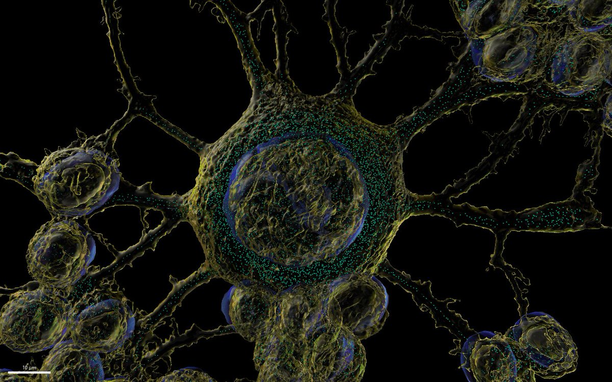 Michael Nesbit (@mlnesbit) on Twitter photo Congrats @CHIRI_curtin image of the month winner Dr Gae Ellison!
Iron (ferroorange) in neuroblastoma cells, rendered using spots and surfaces in <a href="/ImarisSoftware/">Imaris 3D/4D Imaging</a>
Captured using <a href="/AndorTechnology/">Oxford Instruments Andor</a> Dragonfly using <a href="/NikonInst/">Nikon Instruments</a> 60x lens Congrats @CHIRI_curtin image of the month winner Dr Gae Ellison!
Iron (ferroorange) in neuroblastoma cells, rendered using spots and surfaces in <a href="/ImarisSoftware/">Imaris 3D/4D Imaging</a>
Captured using <a href="/AndorTechnology/">Oxford Instruments Andor</a> Dragonfly using <a href="/NikonInst/">Nikon Instruments</a> 60x lens