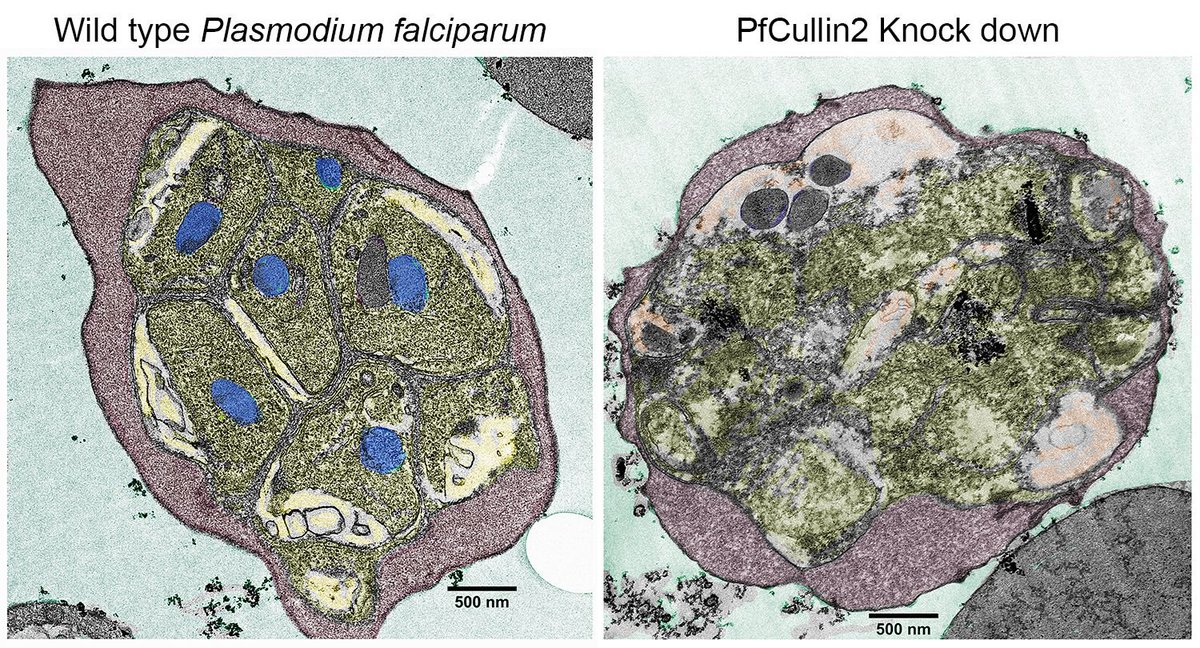 Zeba Rizvi (@zebra_cullin) on Twitter photo Thrilled to share exciting news! Check out my PhD research on Plasmodium #CRLs which is now published with <a href="/PLOSPathogens/">PLOS Pathogens</a>! Huge gratitude to my mentor <a href="/sijwali_puran/">Puran Singh Sijwali</a>, co-authors <a href="/GSRINIV31689349/">G. Srinivas Reddy</a> <a href="/gordesomesh/">somesh gorde</a>, and <a href="/ccmb_csir/">CCMB</a> facilities for their invaluable support. Cheers 🥂 ✨ Thrilled to share exciting news! Check out my PhD research on Plasmodium #CRLs which is now published with <a href="/PLOSPathogens/">PLOS Pathogens</a>! Huge gratitude to my mentor <a href="/sijwali_puran/">Puran Singh Sijwali</a>, co-authors <a href="/GSRINIV31689349/">G. Srinivas Reddy</a> <a href="/gordesomesh/">somesh gorde</a>, and <a href="/ccmb_csir/">CCMB</a> facilities for their invaluable support. Cheers 🥂 ✨