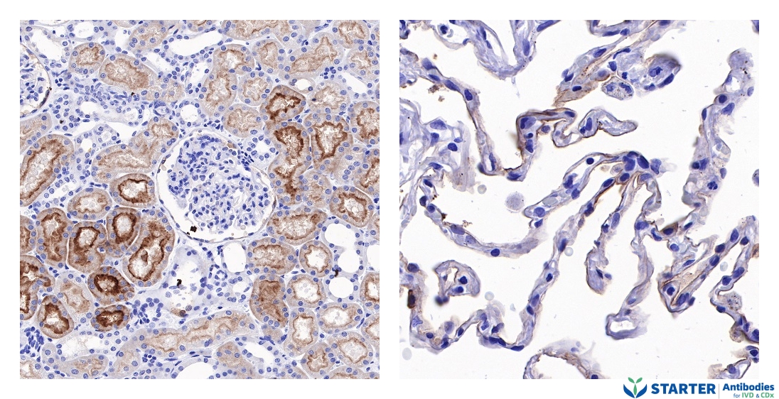 Starterbio's tweet photo. #IHC #antibody #FOLR1

Human folate receptor alpha Recombinant Rabbit mAb (SDT-719-20)
Catalog Number: S0B2276
Location: Cell membrane
Application: IHC-P; WB

Find more: https://t.co/jQT0fgHZx8
#biotech #lifescience #recombinant #CDx #IVD #cancer #pathology #Immunohistochemistry https://t.co/OHMmm6bzDT