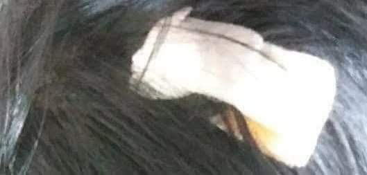 2019년05월18일 (토) 폭행 사건 현대병원 진단서 나와서 국가에서 보라고 올렸습니다.

두개골골절 의심되는 선이 있으나 과거의 것인지 확인이 어려워 가족에게 연락이 안됨, 경찰에 인계됨. 증상은 두개내 병변 사료되지 않으나 골절이 맞다면 CT 체크 해봐야함을 성명.