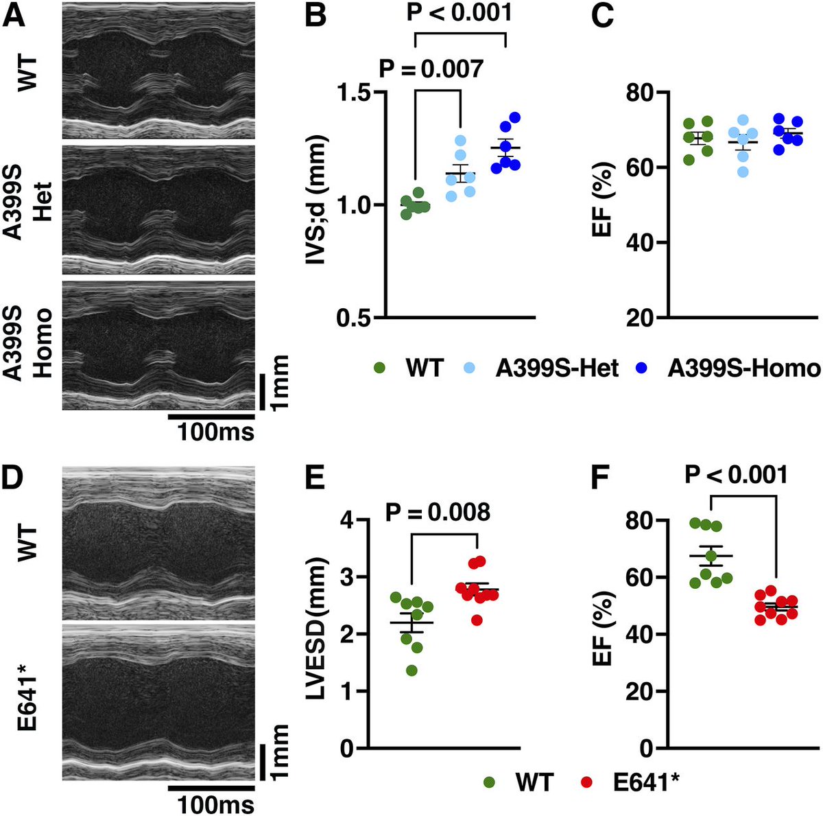 Lipidomic analysis by Lahiri et al. published in LSA shows unique alterations in the cardiac lipid composition in mice with hypertrophic and dilated cardiomyopathy caused by JPH2 variants <a href="/xwehrens/">Xander Wehrens</a> <a href="/lahiri_satadru/">Satadru Lahiri</a> <a href="/bcm_cvri/">BCM_CVRI</a> <a href="/BCMIntegrPhys/">BCM Department of Integrative Physiology</a> bit.ly/48DflNf