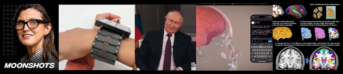 neurosock's tweet image. The world waits in suspense to hear new details about Neuralink&apos;s patient implant.

In the meantime, updates from Meta, Cathie Wood, Russia, Stanford, World Summit, $346K for Neurosity, and $1.3B in neuro VC investments.

Here&apos;s everything going on in AI-Brain-Chips right now: