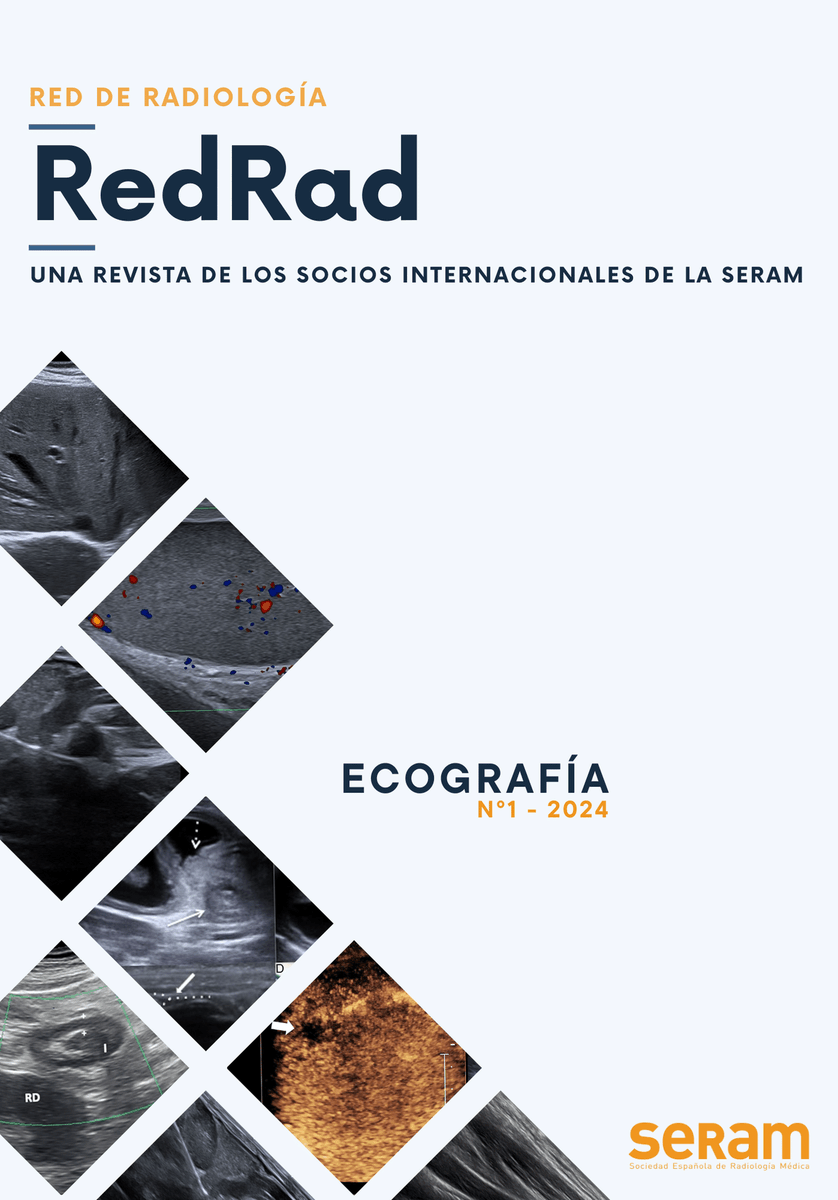 SERAM_RX's tweet photo. ¡Tenemos novedades! Te presentamos #RedRad, una nueva revista que refleja la diversidad de la comunidad radiológica internacional

🌐 En esta primera edición, ahondamos en la #Ecografía en el mundo

Puedes leerla de forma gratuita aquí🔗https://t.co/sdGmBc5dqq https://t.co/5prYqklyJN